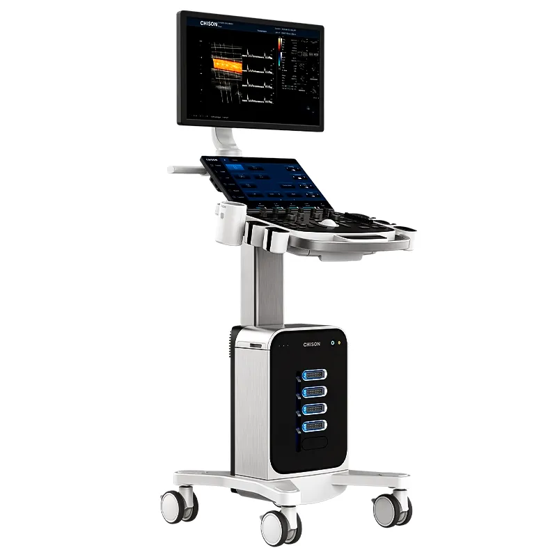 Ultrasonido Chison SonoMax 7 - Imagen 2